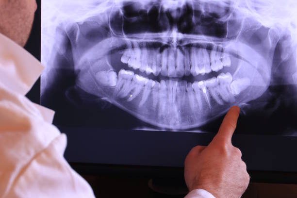 Best Emergency Broken Tooth Repair in Boardman, OR